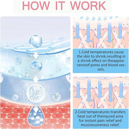 Ice Roller for Face Eyes Body || Rodyon