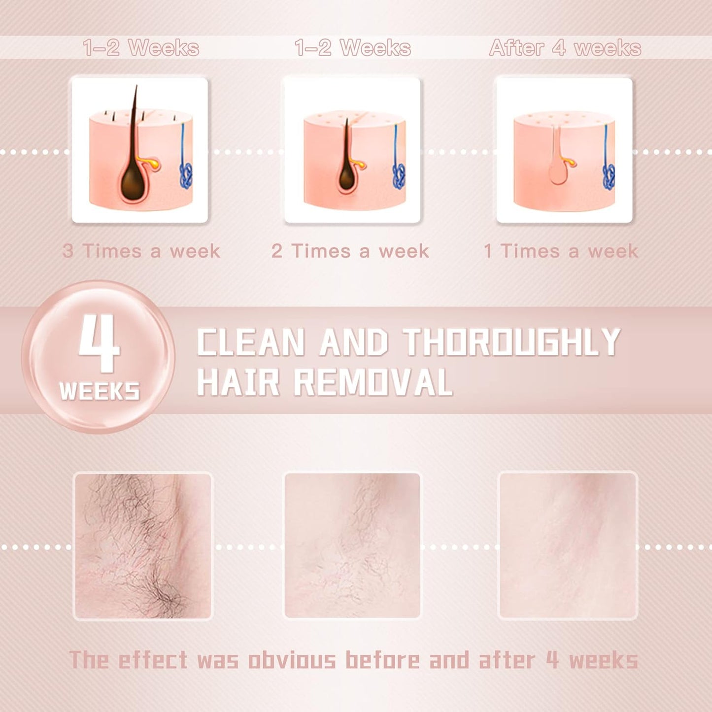 IPL Laser Hair Removal Device for Women and Men || Rodyon