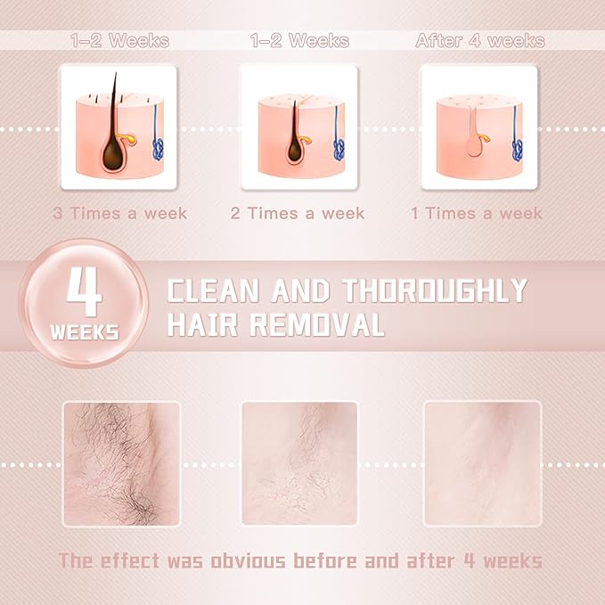 IPL Laser Hair Removal Device for Women and Men || Rodyon