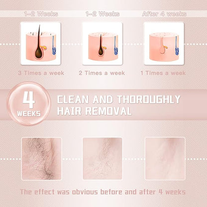 IPL Laser Hair Removal Device for Women and Men || Rodyon