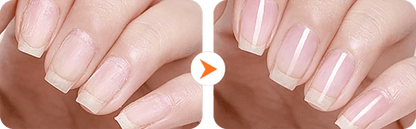 2-in-1 Electric Nail Clipper & Polisher || Rodyon